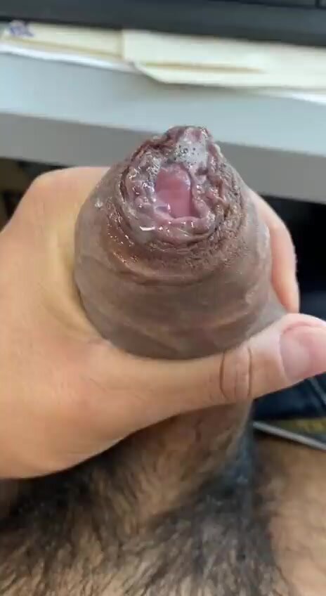 Smegma pre cum