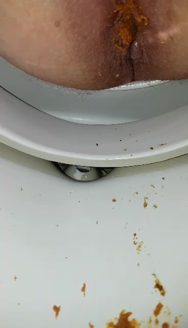 Sloppy shit eruption in toilet view
