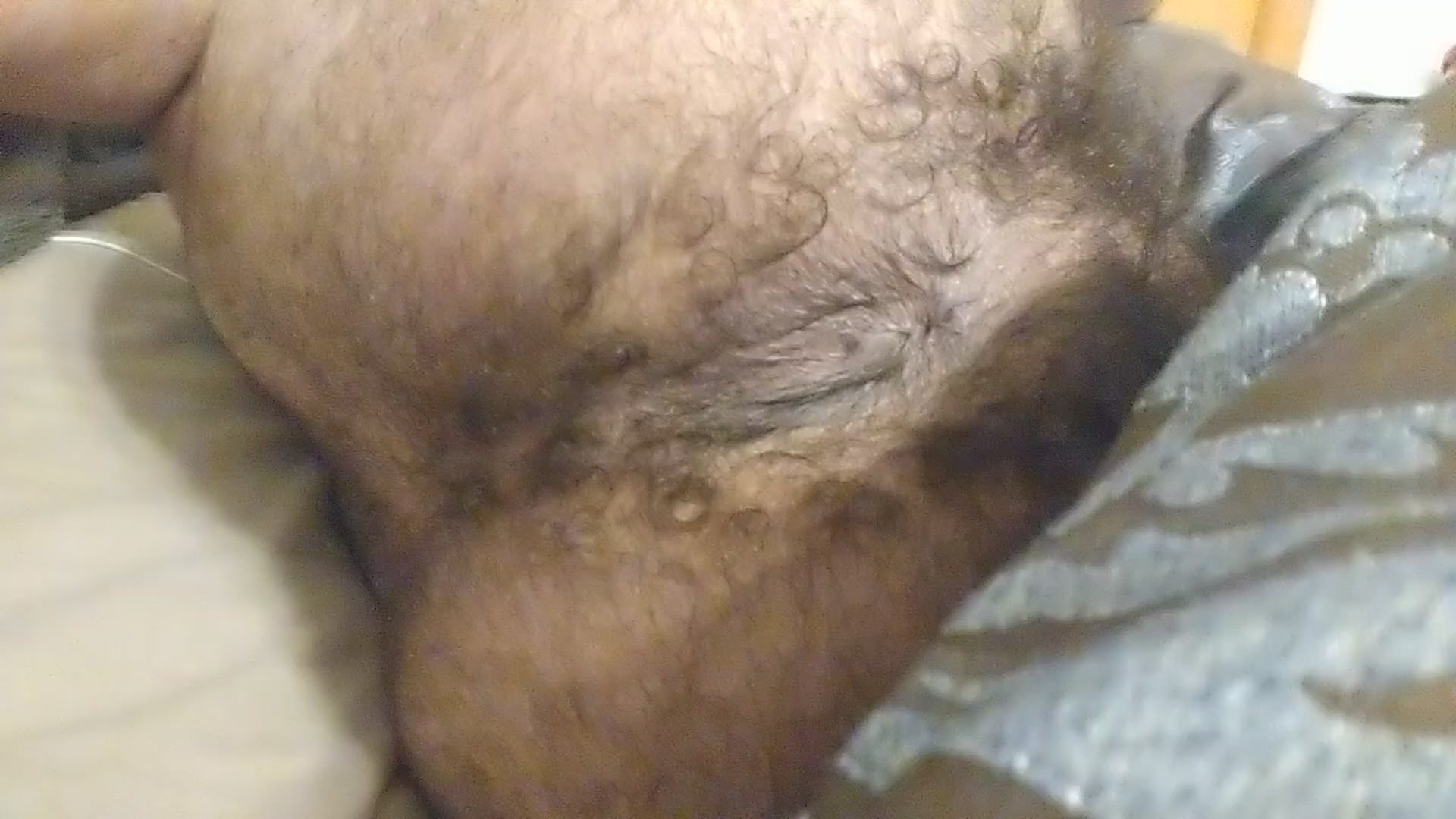 Hairy Ass Farts