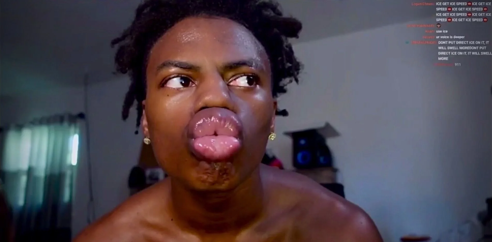 IShowSpeed swollen DSLs - ThisVid.com