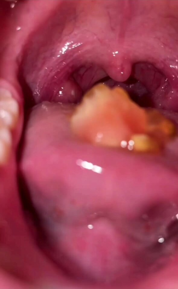 China girl swallows food