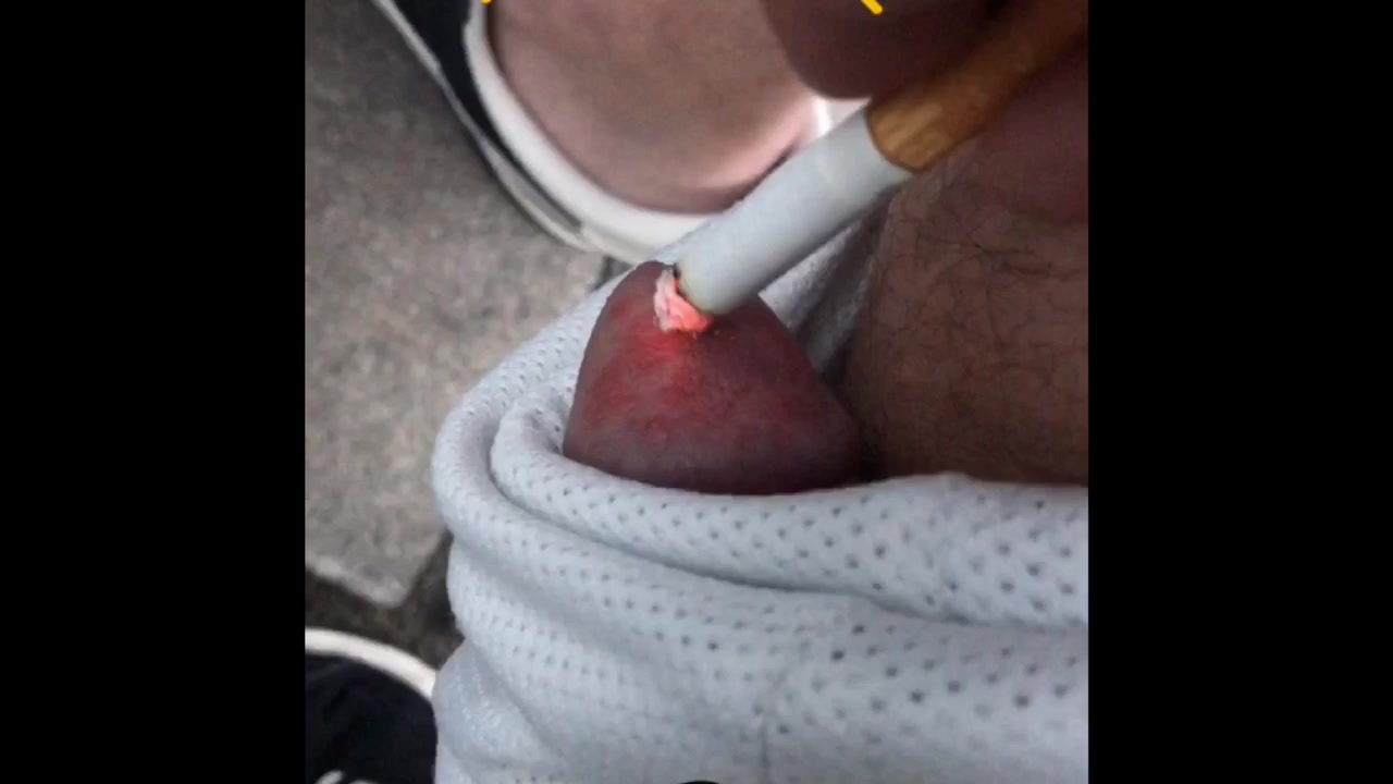 Bizarre Burning The Head Of My Dick With A…