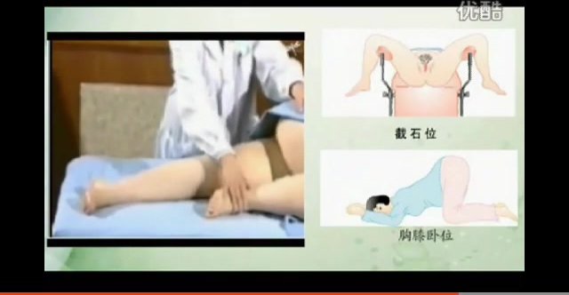 Female Chinese rectal exam