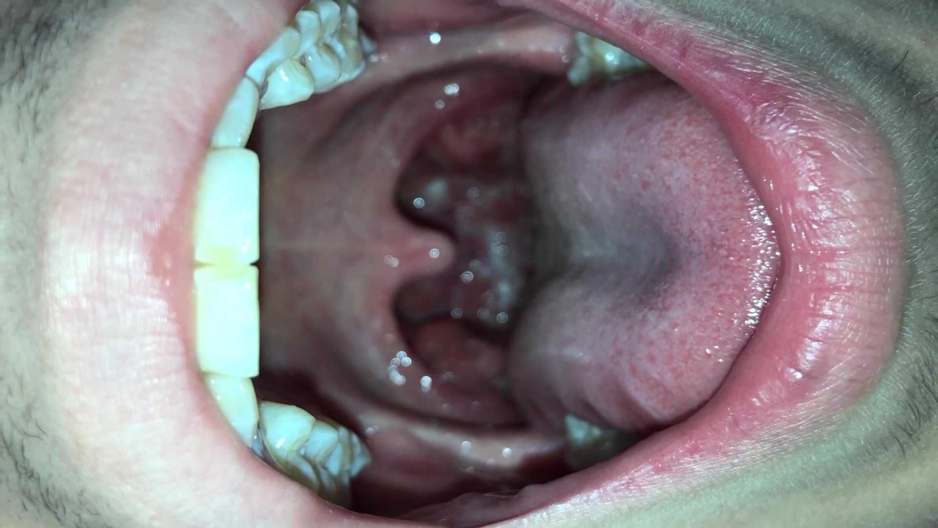 My Mouth - video 2