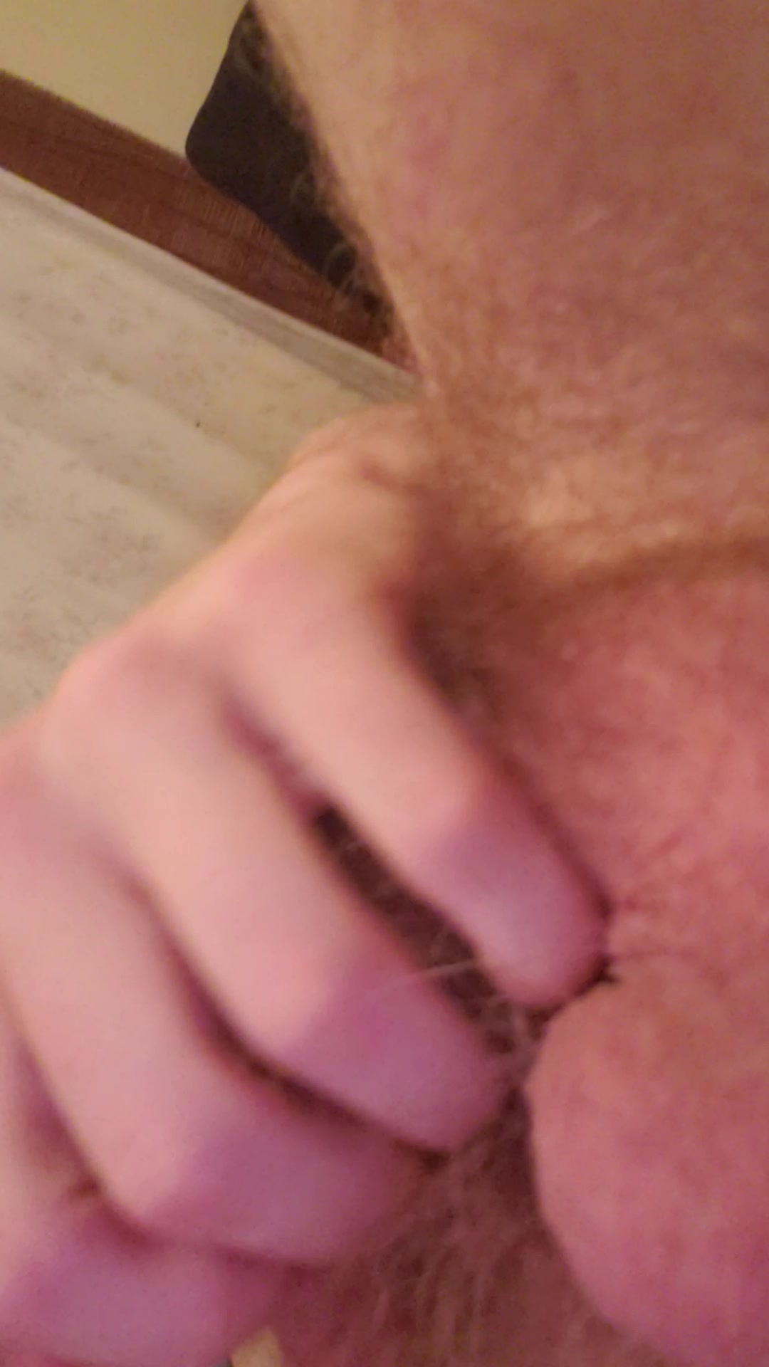 Hairy balls
