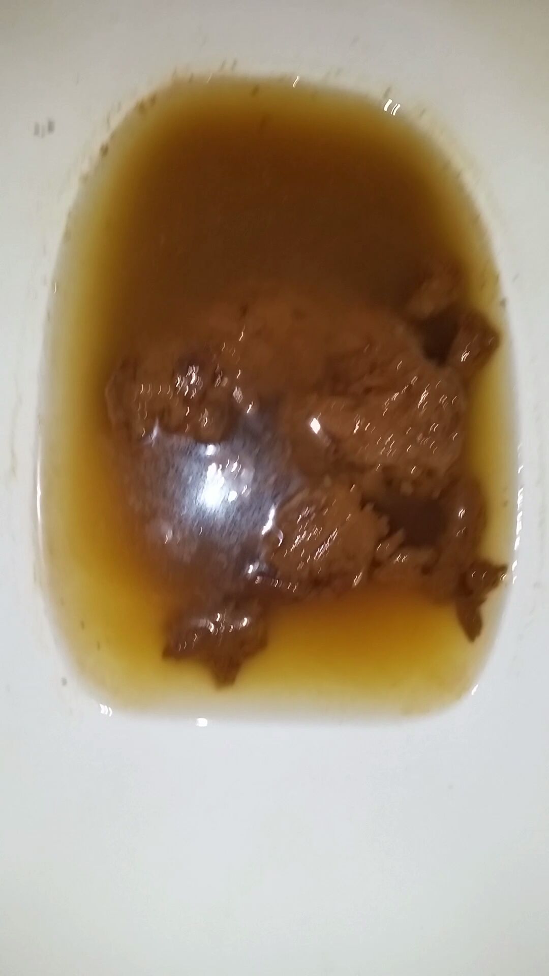Diarrhea & poop