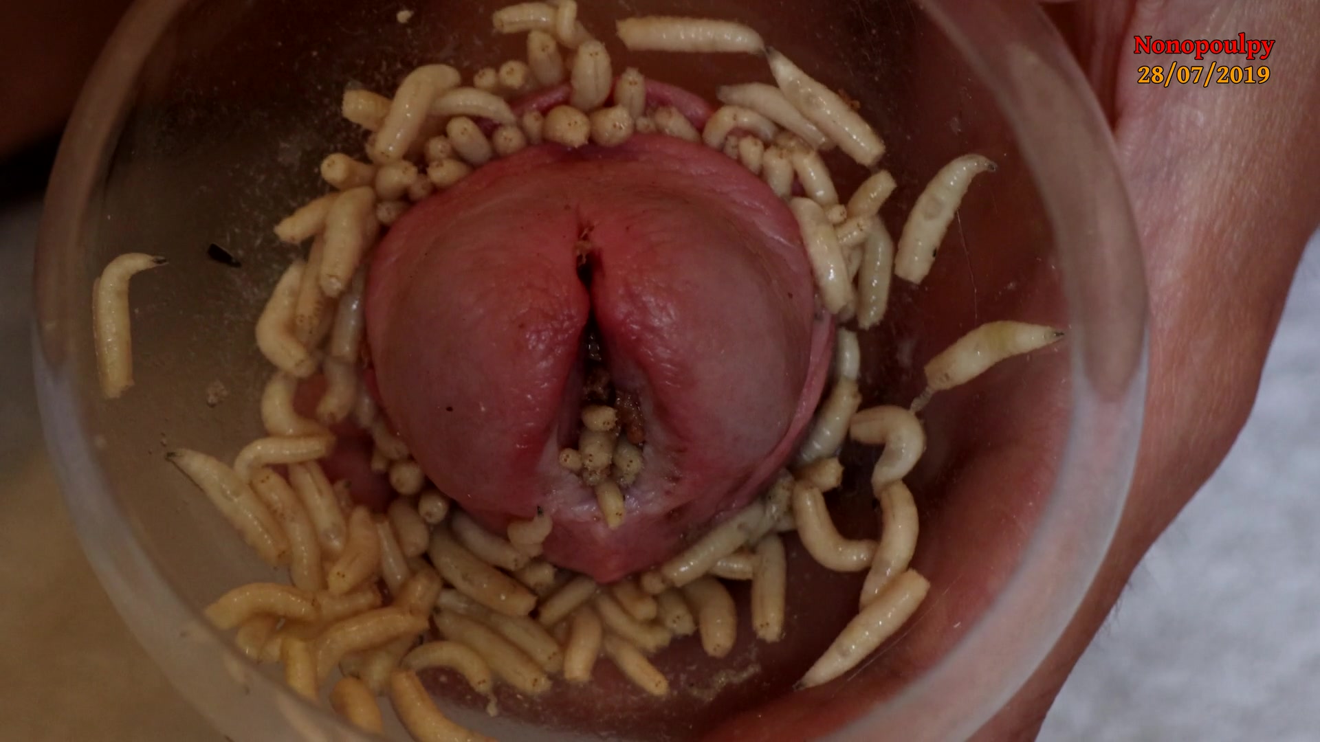 Maggots in foreskin and peehole