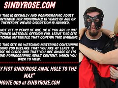 MrPlay fist SindyRose anus hole to the max until it fall out with prolapse
