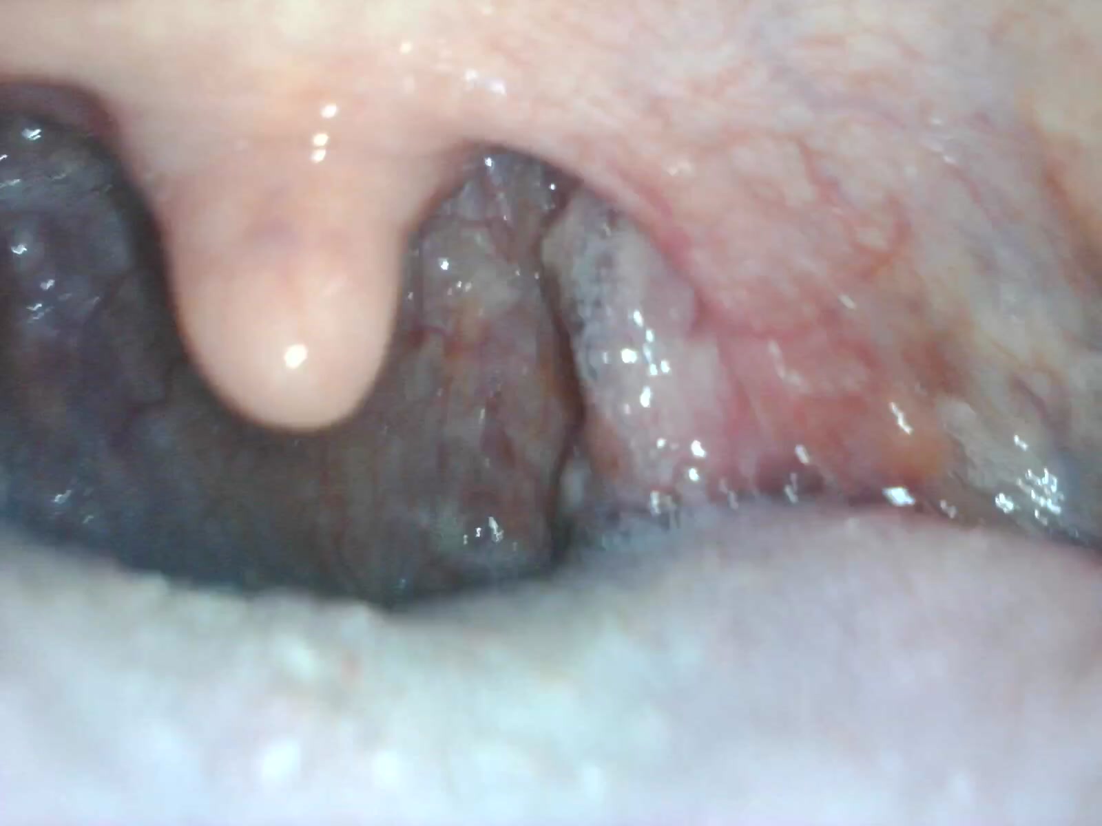 Inside of a man mouth