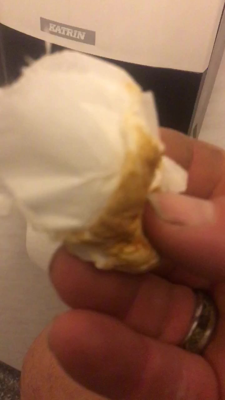 Eating shitty toilet paper.