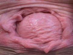 CERVIX PROLAPSE AND PUSSY GAPING FROM ANDA