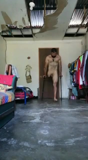 Nude amputee