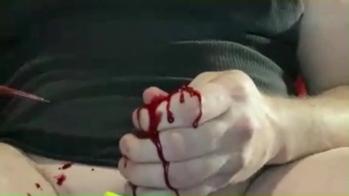 Bloody: Freak boi bleeds from cock like aâ€¦ ThisVid.com