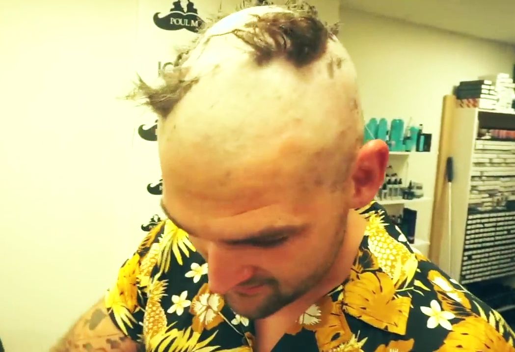 Depilatory Cream Destroys Danish Guy's Hair