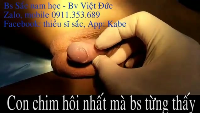 Doctor examining asian dick