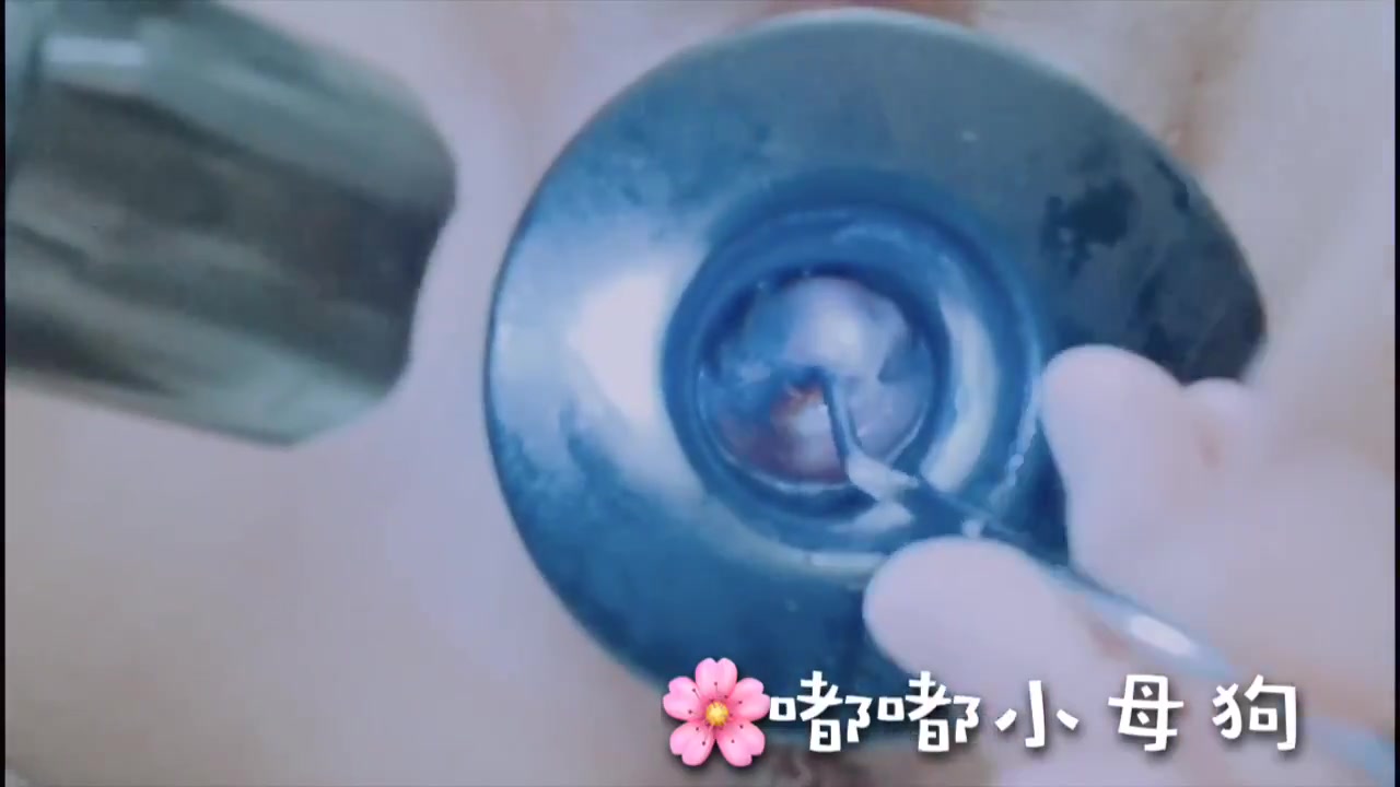 Japanese inserts curved sound in her cervix