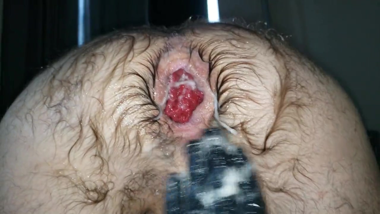 Hairy ass fisted