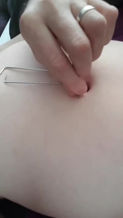 Navel torture