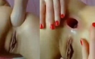 Slim sexy girl anal fisting  and gapes asshole