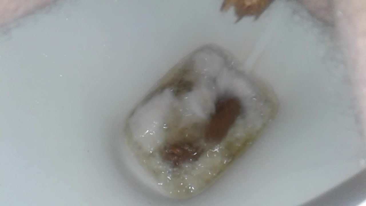 My poop 09 02 2020