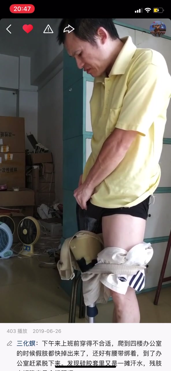 Amputee man 003