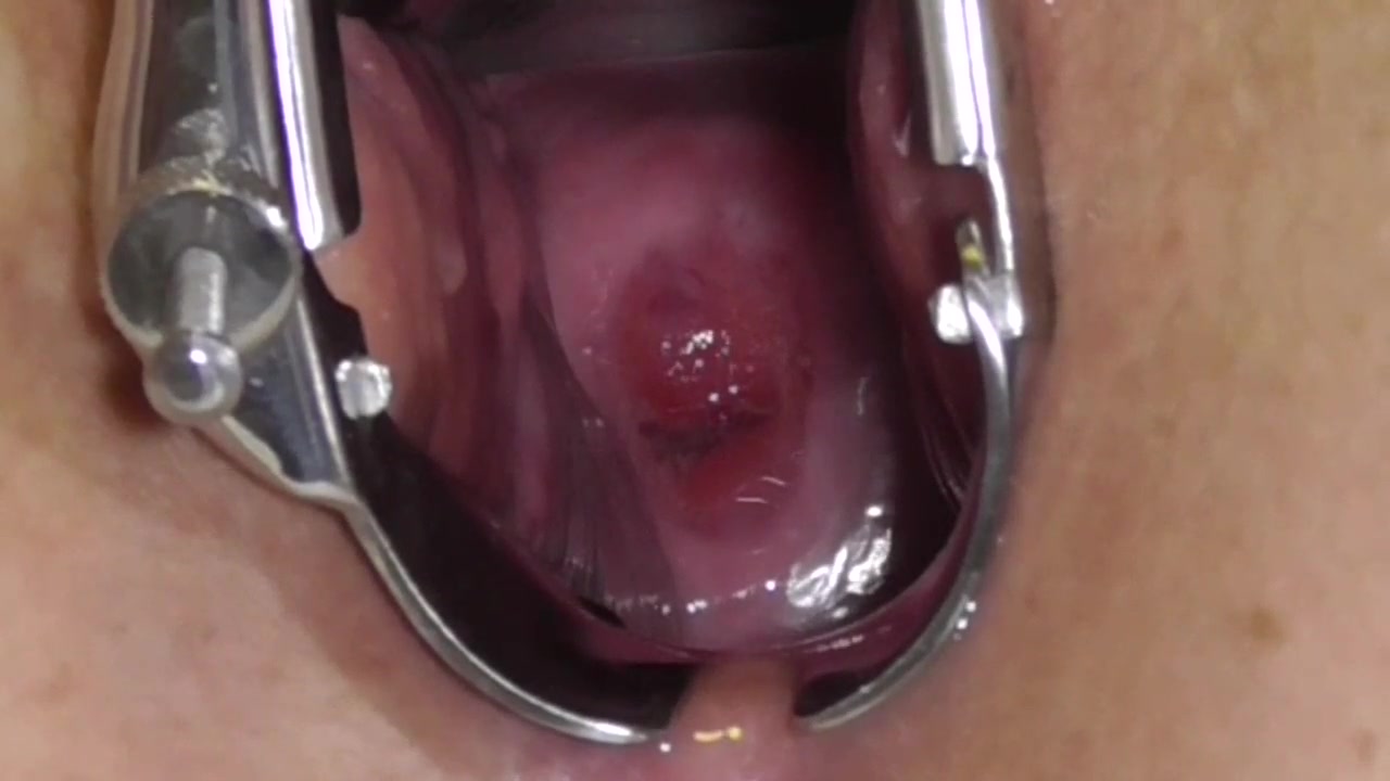 Cervix Play - Speculum, sound, finger, piss all in or on her cervix