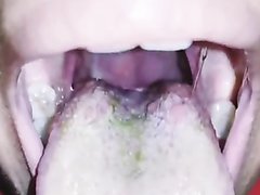 Unbrushed Tongue
