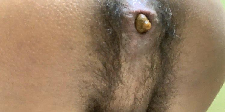 My massive corny shit! (19m)