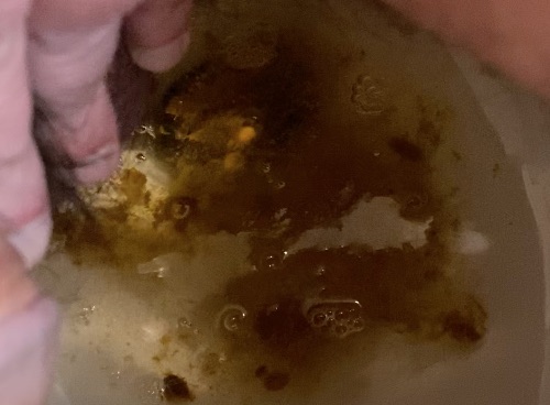 Corny Diarrhea, Dripping Hole