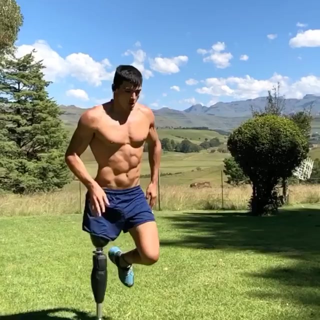 Amputee boy running with his prosthetic