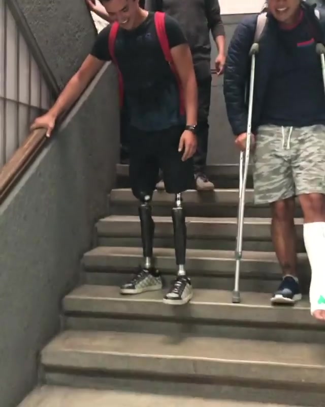 DAK amputee and broken leg on crutches