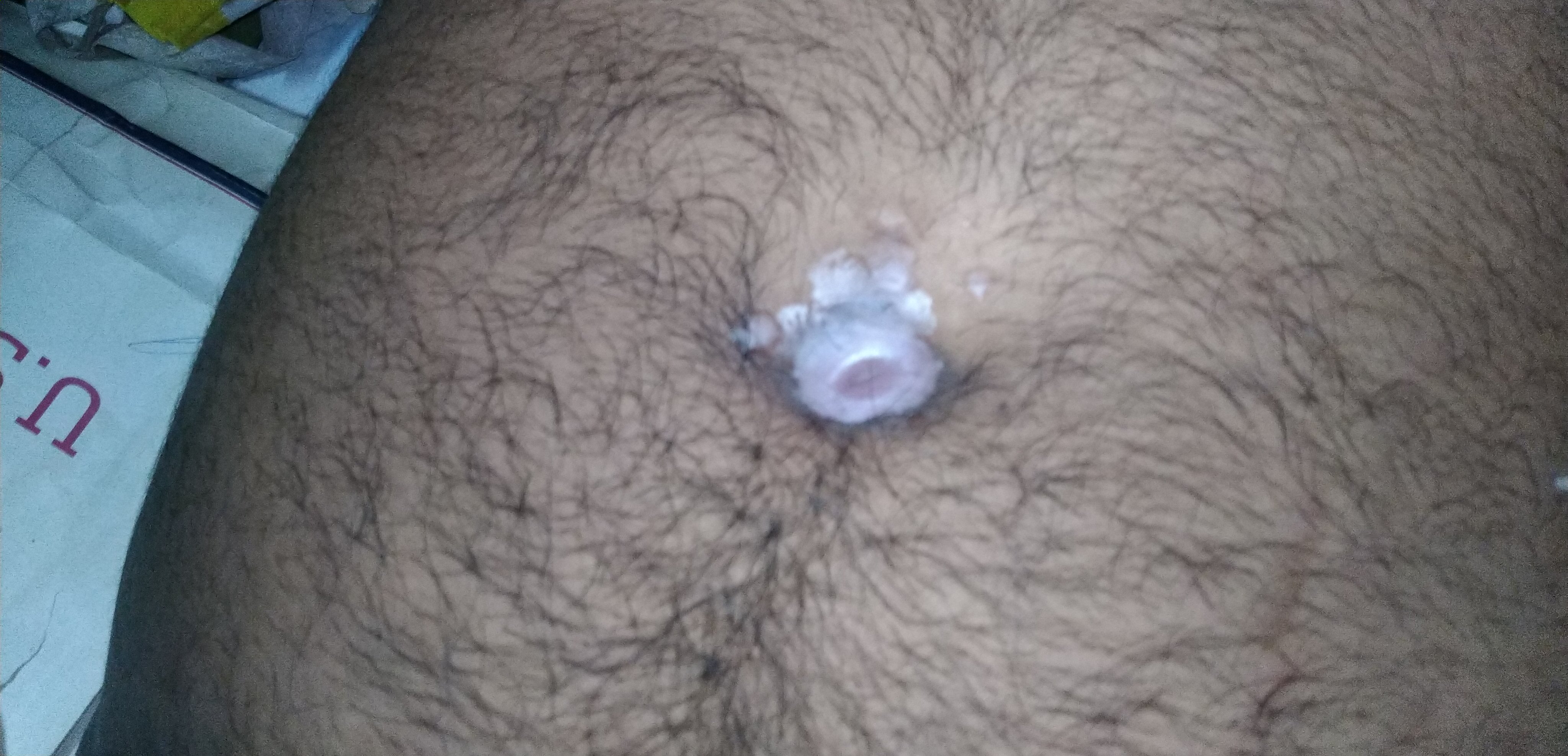 hot candle wax in my navel