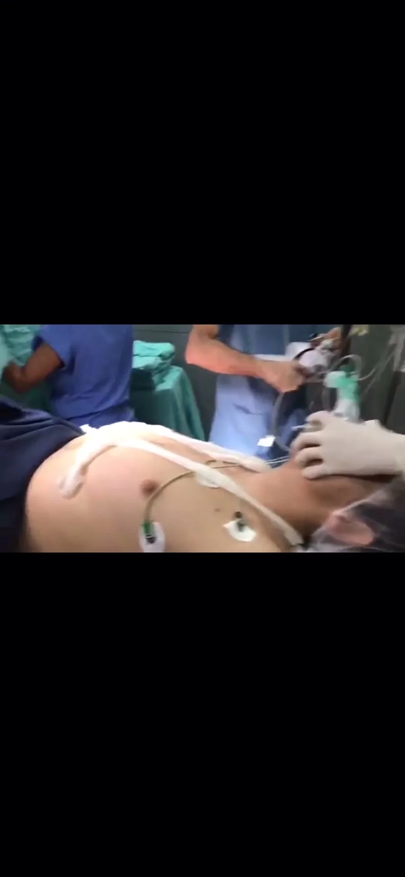 Intubation Porn - Young guy given anesthesia and intubation - ThisVid.com