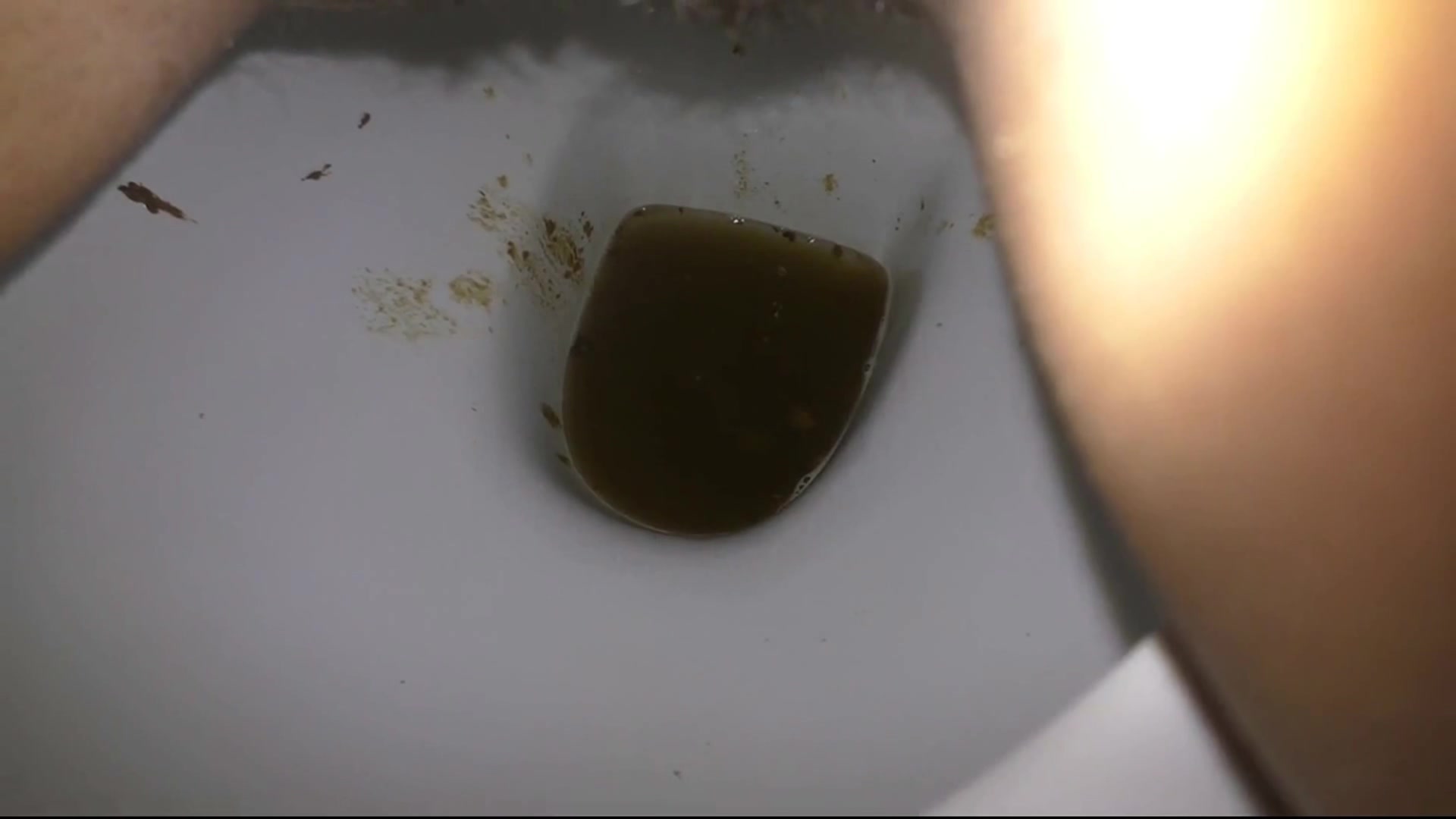 beautiful girl poops diarrhea - video 2