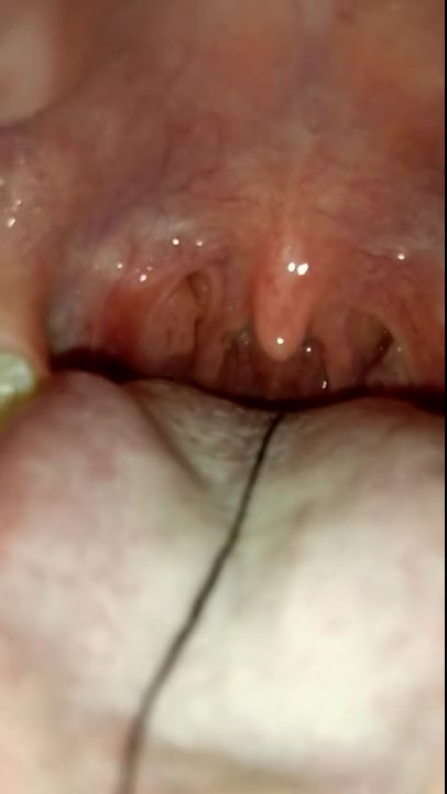 Asian girl playing her throat with string and gagging