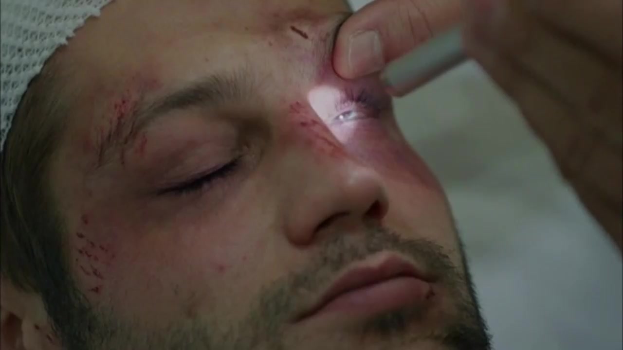 eye check 4