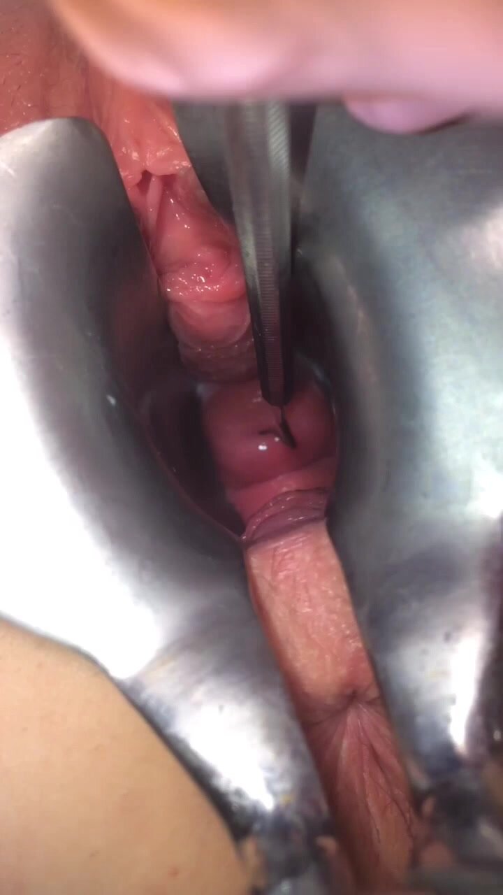 Cervix piercing