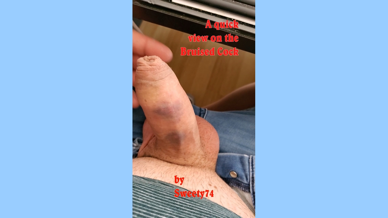 Quick View Bruised cock