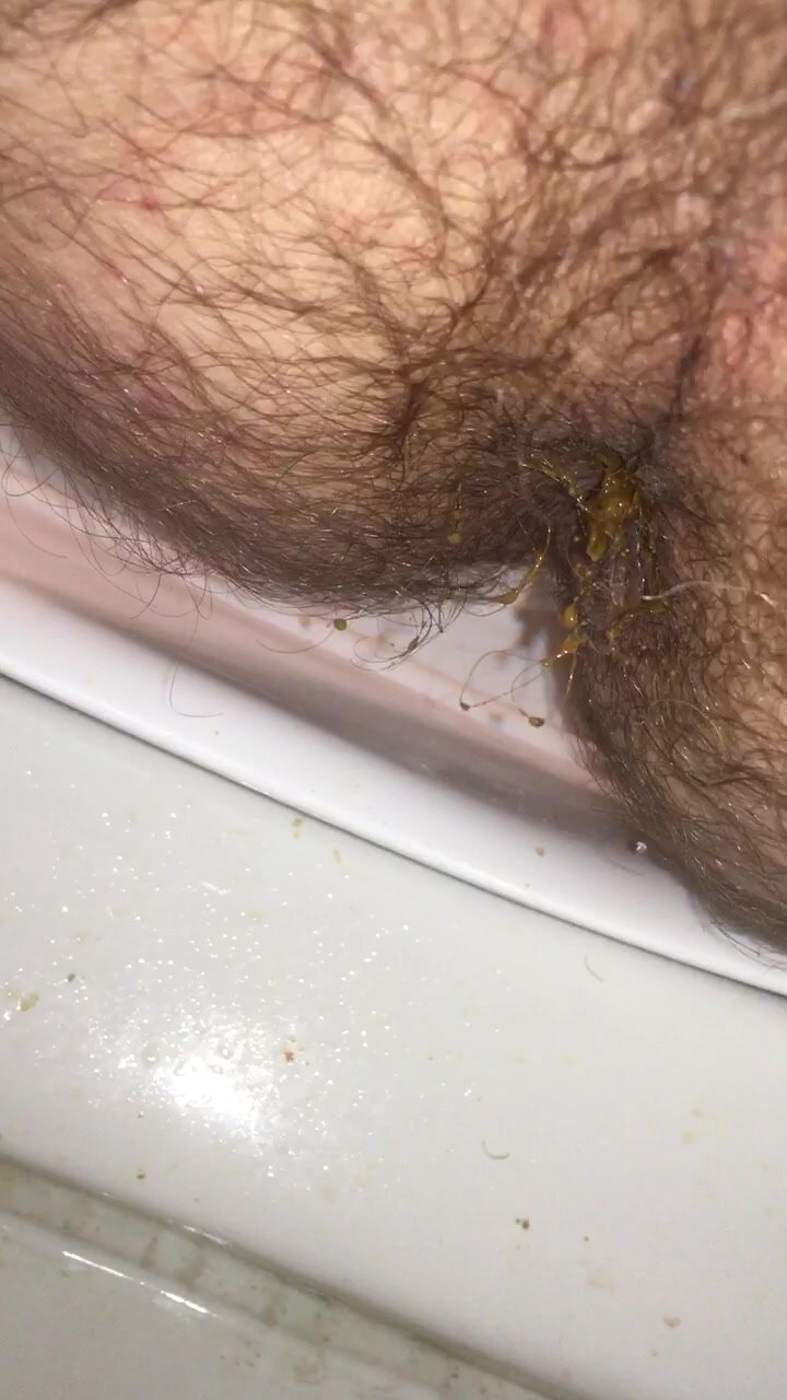 Diarrhea morning poop