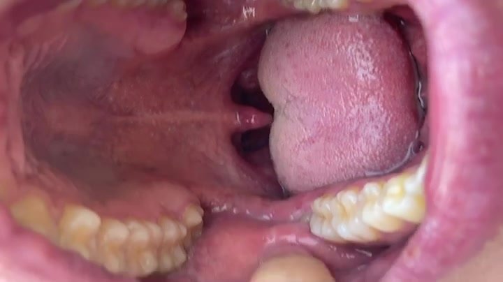 mouth video