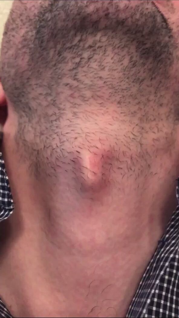 Adam’s apple deep voice