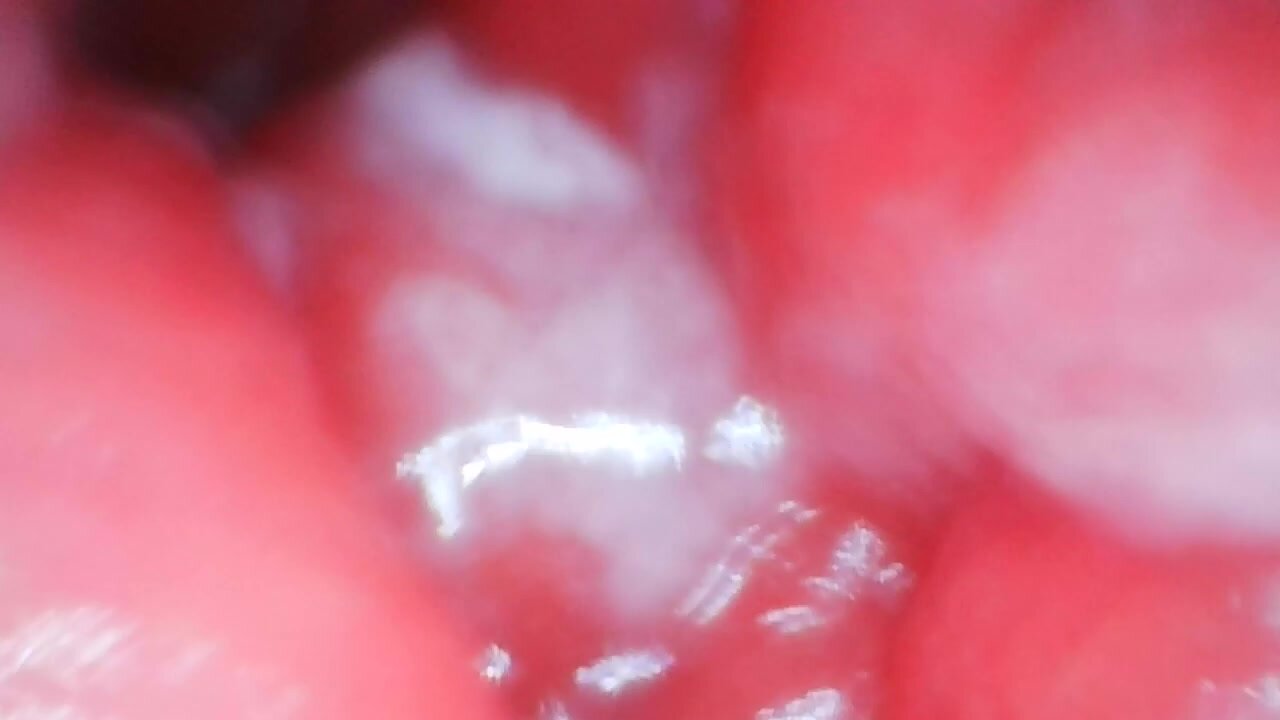 ANAL HOLE INSIDE ENDOSCOPE VIEW FILLED WITH CUM 11 04 2020