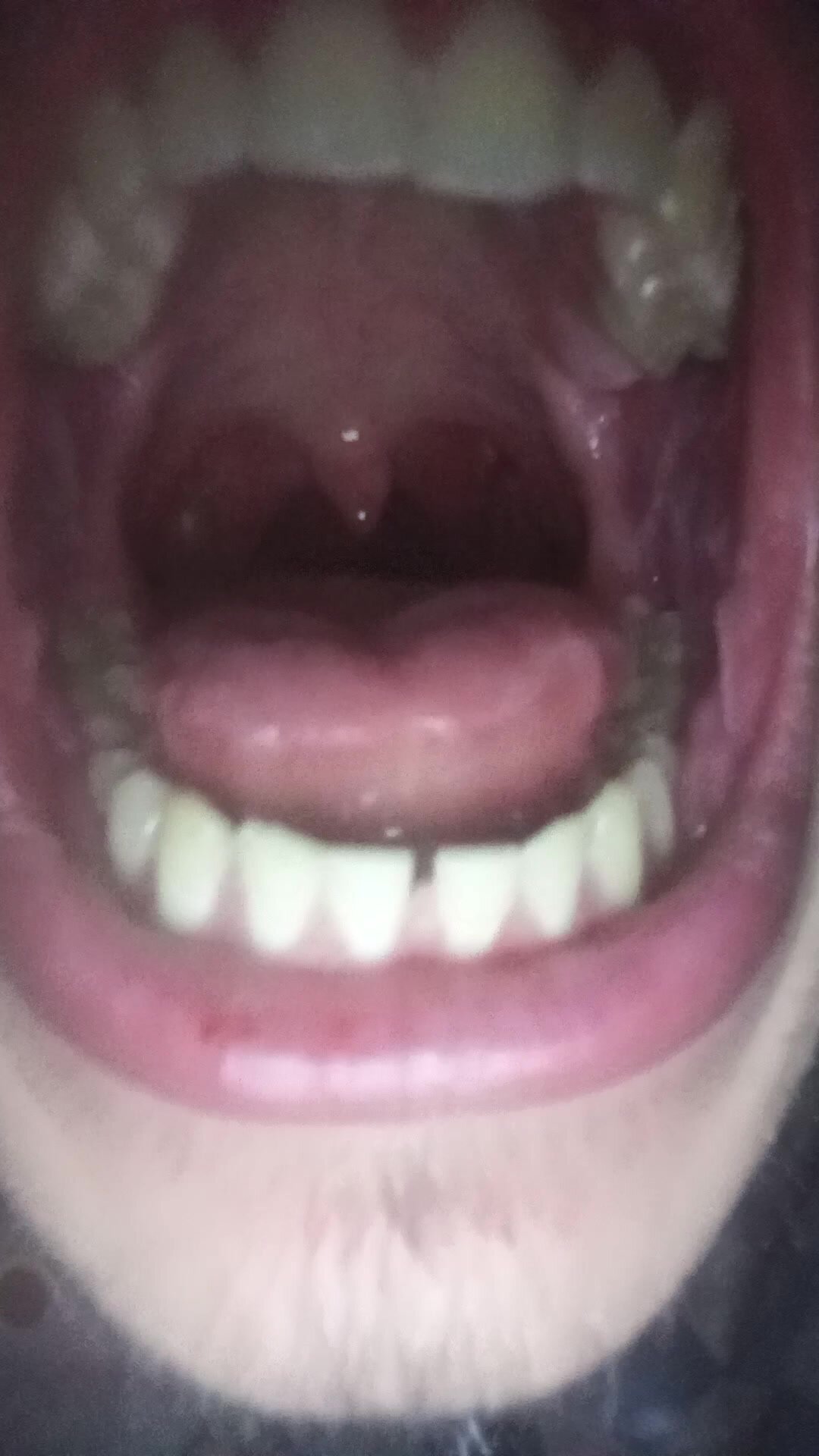 Mouth Vore