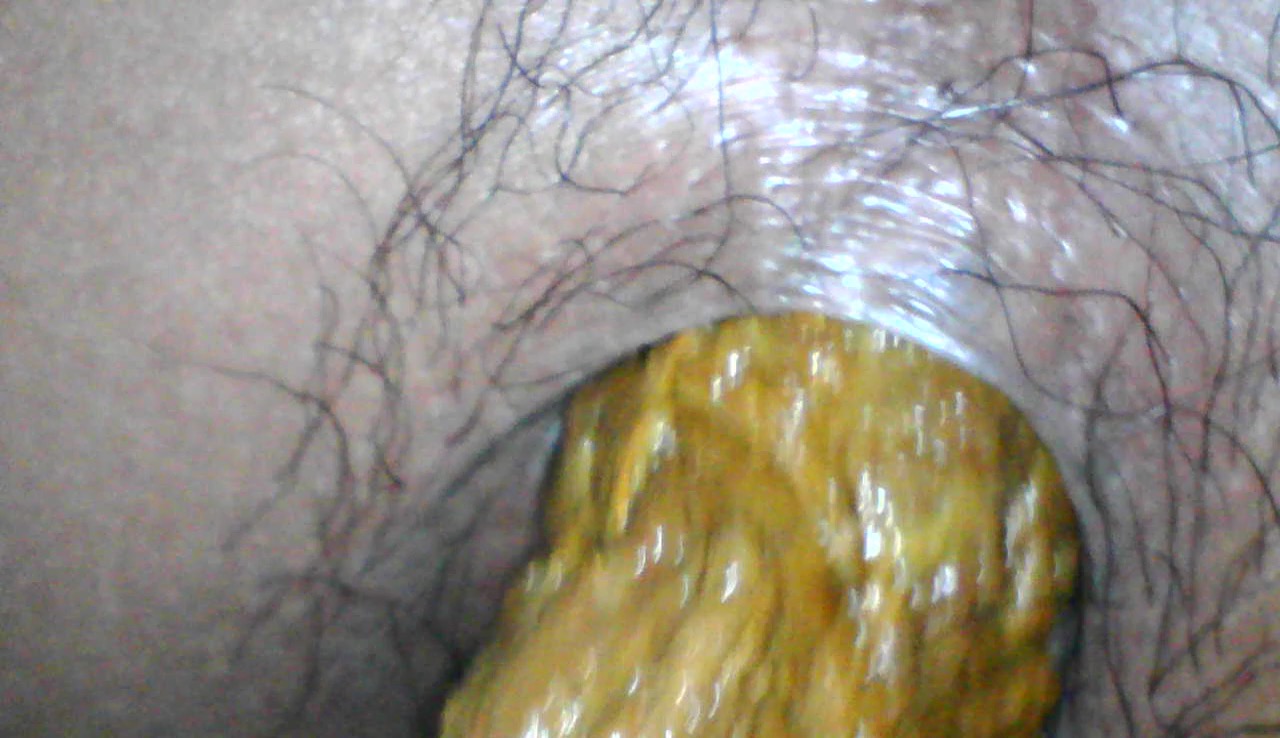 Close up of my anus shitting