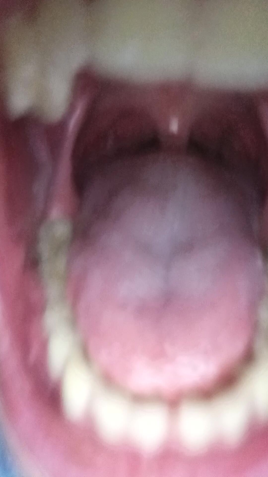 Mouth Video 2