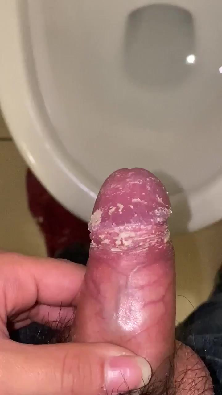 pissing smegma cheese