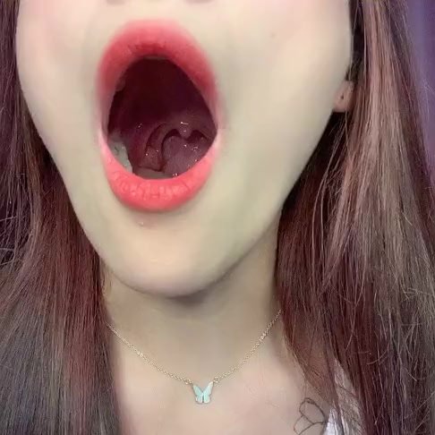 18-year-old Chinese Girl's uvula and throat