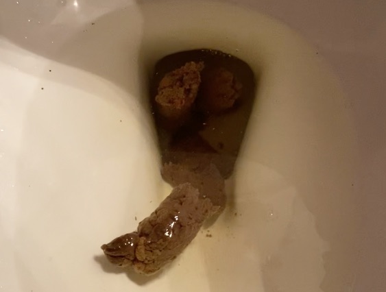 Several Plops of Shit