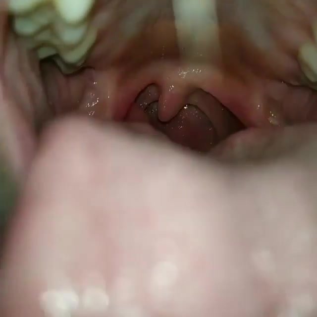 My girlfriend throat uvula fetish #5