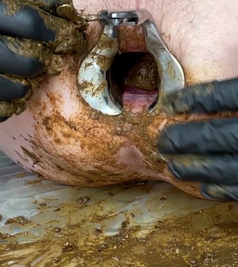 Stuffing shit into speculum